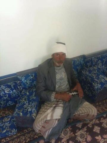 طريقة جديدة للسرقة في اليمن .. هذا ماحصل للأضرعي في محافظة ذمار