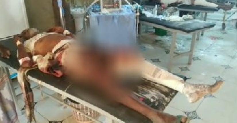 اول تعليق للأمم المتحدة حول استهداف صالة افراح بالحديدة