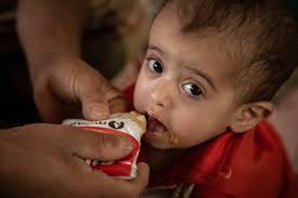 الامم المتحدة : مستويات الجوع في اليمن تتفاقم وهذا هو الحل الوحيد