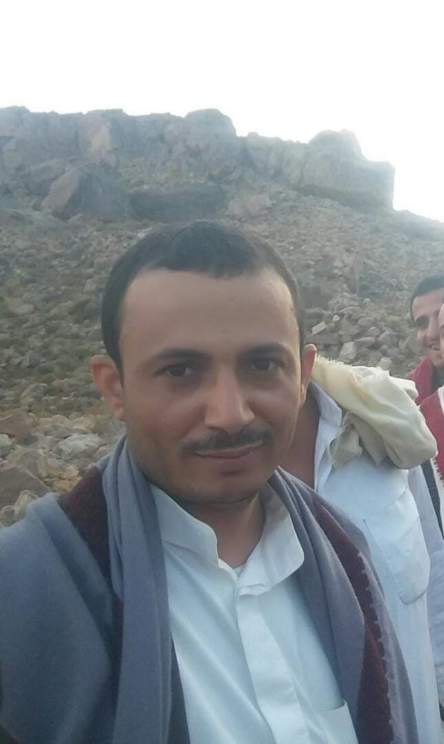 قسم رأسه إلى نصفين .. تفاصيل مقتل شيخ قبلي وسط العاصمة صنعاء