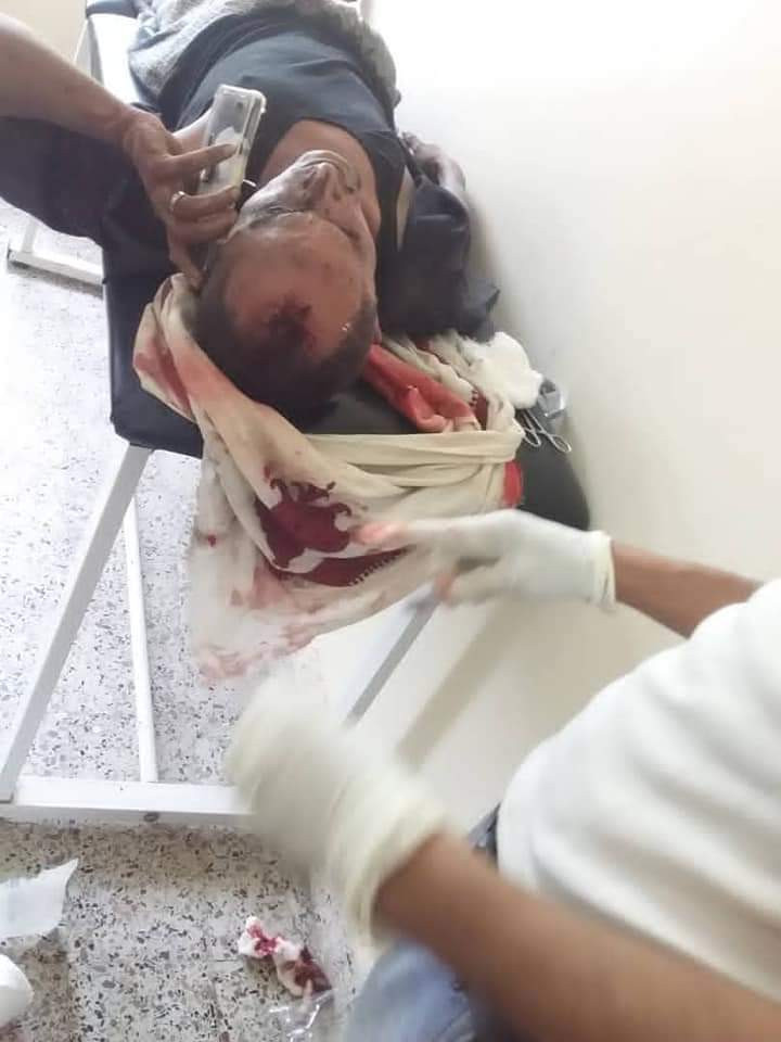 لحج: اصابات خطيرة في حادث سقوط حافلة من جبل مرتفع (صور)