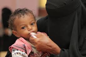 الأمم المتحدة … 7.6 مليون يمني يعانون من سوء التغذية