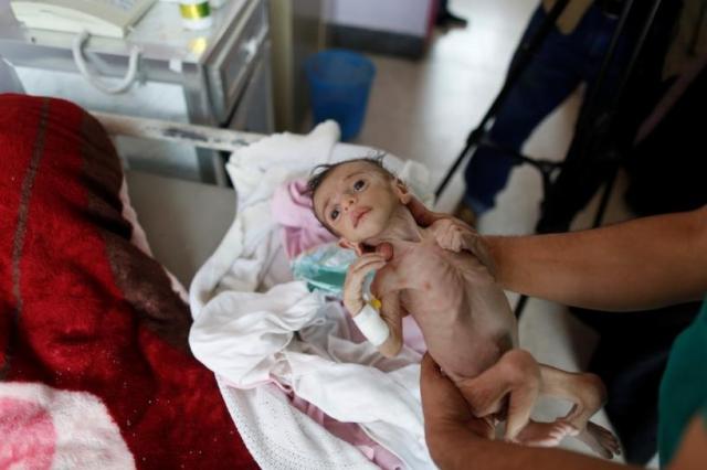 الأمم المتحدة تكشف عن رقم مهول من الأطفال قضوا خلال الحرب في اليمن