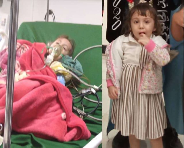 جرائم المستشفيات في اليمن .. عملية لوز تفقد طفلة بصرها وتدخلها في غيبوبة