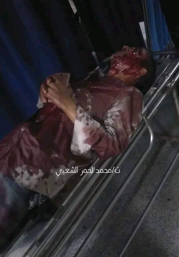 عاجل: شاهد ماذا يفعل وزير خارجية الشرعية في عدن بعد التفجير الإرهابي (صورة)