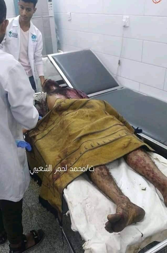 مكتب الصحة بعدن يغطي على أعداد ضحايا الإنفجار عقب تصريح رسمي كُشفت فيه الأرقام الحقيقية