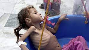 الأمم المتحدة : هكذا يسد اليمنيون بطونهم الخاوية