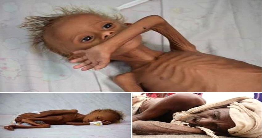 البنك الدولي يصنف أربع محافظات يمنية في المرحلة قبل الأخيرة من المجاعة