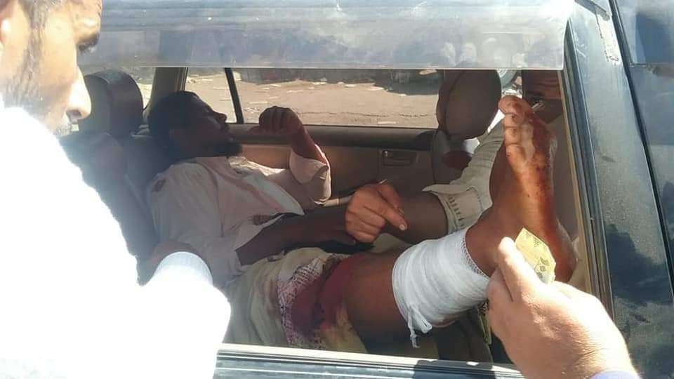 إصابة شخصين في انفجار عنيف هز سوق مدينة شقرة في أبين