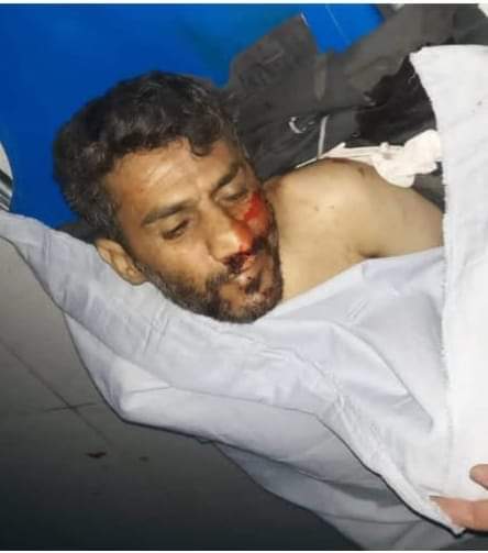 تفاصيل مقتل شخصية اجتماعية في صنعاء ” صورة “
