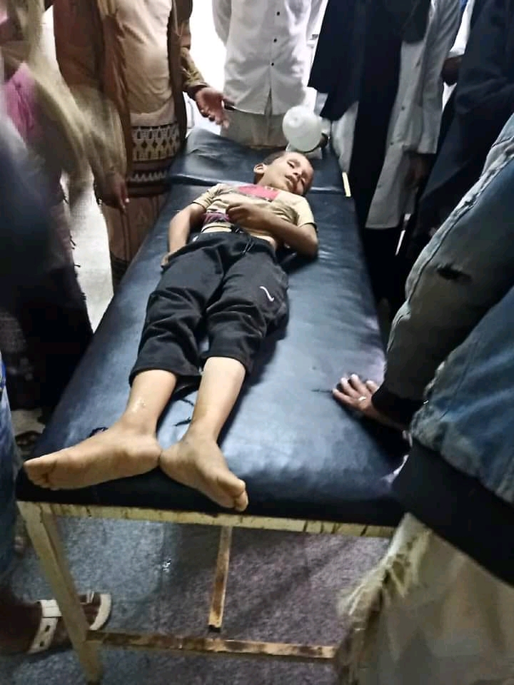 وفاة طفل بعد دهسه من طقم أمني في أبين (صورة)