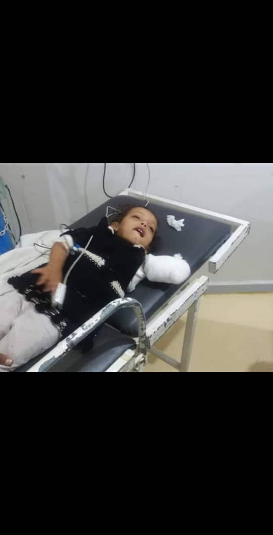 بسبب سياج غير محكم.. أسد يلتهم يد طفلة في حديقة الحيوانات بمحافظة إب “صور”