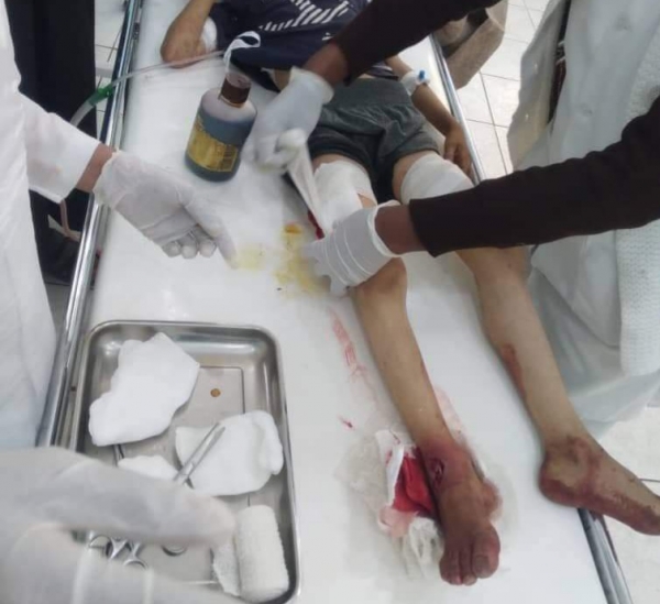 قصف صاروخي على مخيم للنازحين جنوب مدينة مأرب.. وهذا هو عدد الجرحى