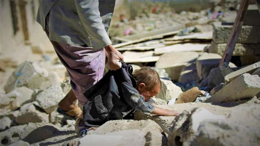 وفاة 377 ألف شخص معظمهم أطفال في اليمن