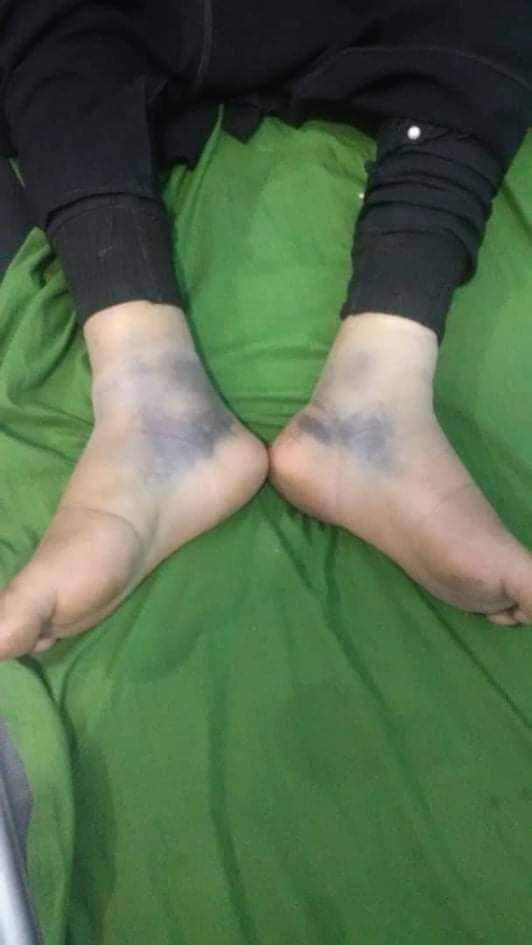 في جريمة مروعة.. عصابة تقتحم منزلا في إب وتقوم بسرقته وضرب ربة المنزل ” صورة “