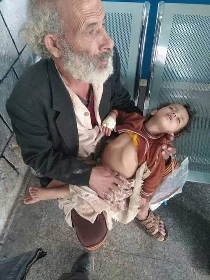في اليمن .. مستشفى حكومي يطرد طفلا بعد عجز والده عن دفع الحساب ” صور مؤلمة “