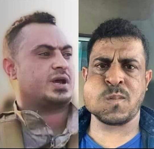 صحفي : اشتباكات عدن تمت بين بلطجي وإرهابي وهذا هو السبب الحقيقي وراء إندلاعها