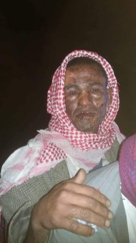 الجرائم تتوالى من محافظة إب .. شبان يصبون البترول على جسد رجل عجوز ويقومون بإحراقه  “صور “