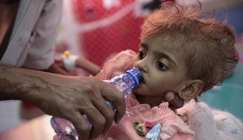 منظمة : اليمن في المرتبة الثانية تضررا من إنعدام الأمن الغذائي
