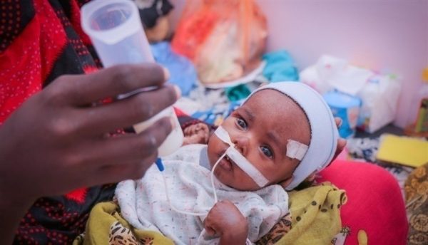 اليونيسف : ملايين الأطفال يعانون من سوء التغذية في اليمن
