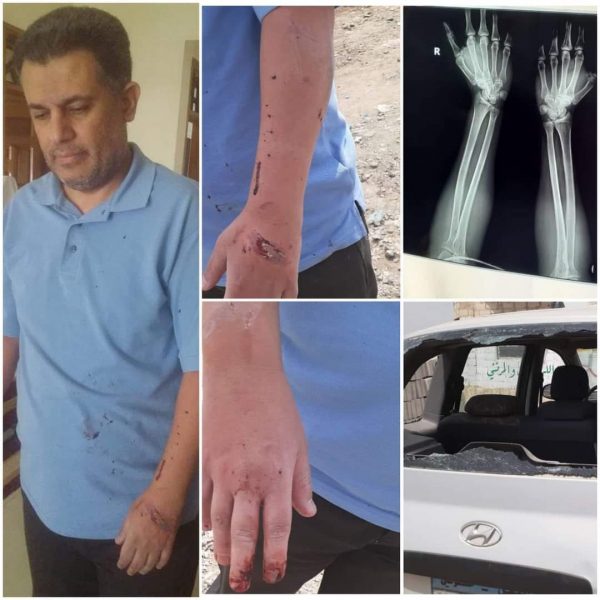 صنعاء : الإعتداء بالضرب المبرح على الأكاديمي إبراهيم الكبسي 