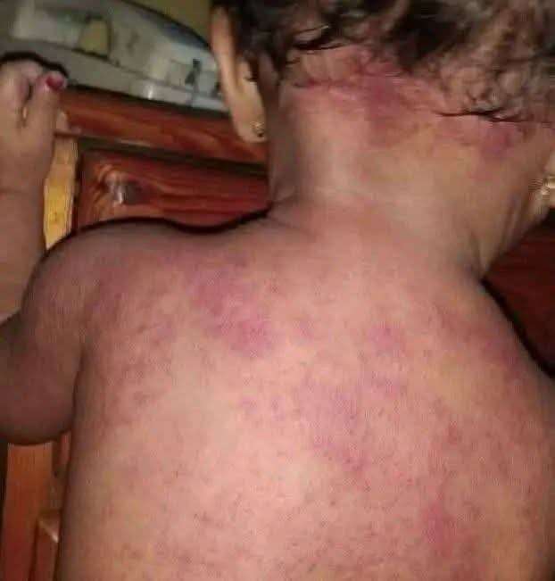 عدن تحت وطأة الحر وانقطاع الكهرباء.. أزمة متصاعدة ووعود دون حلول